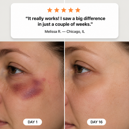 💥100K+ SOLD💕- LUMIVO® Bruise Repair & Skin-Strengthening Cream